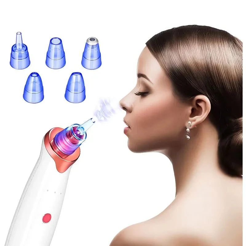 🔥 Succionador poros - ¡El Fin de los Puntos Negros en 3 Minutos!