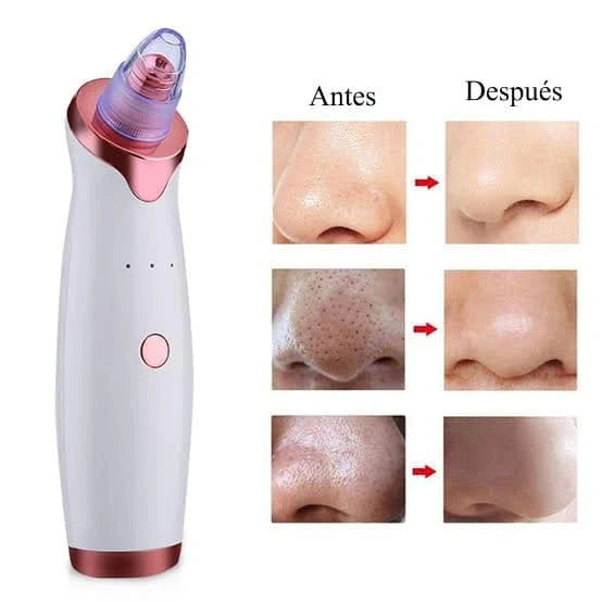 🔥 Succionador poros - ¡El Fin de los Puntos Negros en 3 Minutos!